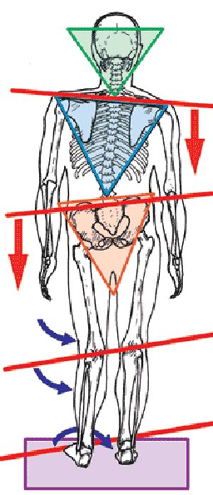 spinal torsion