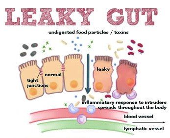 leakyGut